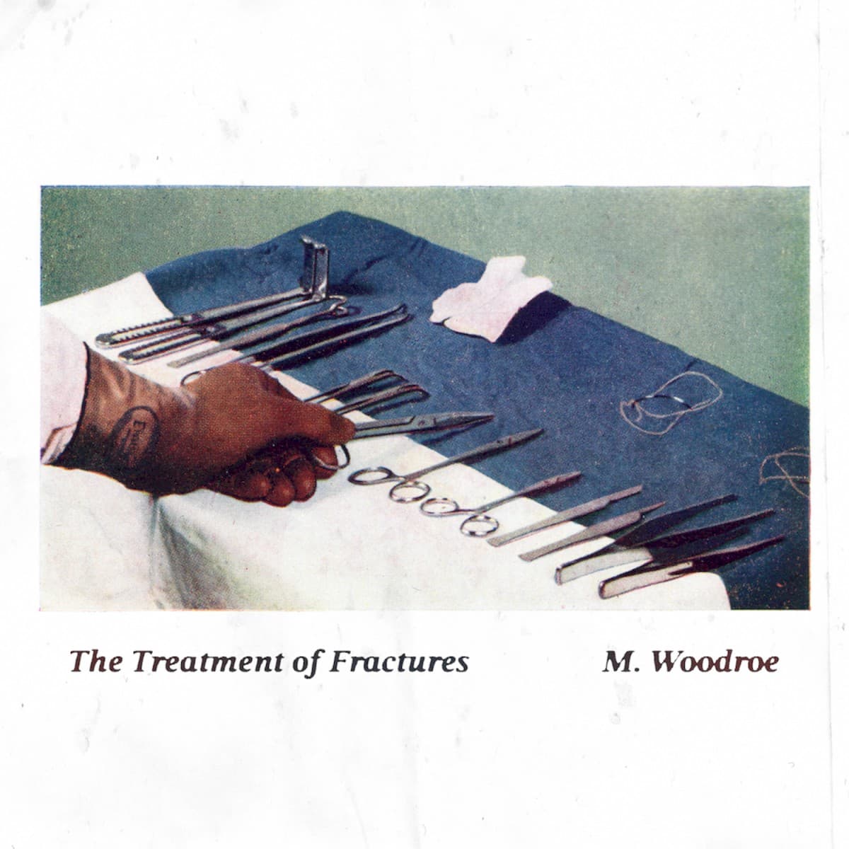 The Treatment of Fractures